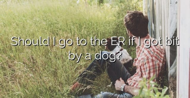Should I go to the ER if I got bit by a dog?